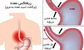 آن ها که تُرش می کنند، بخوانند