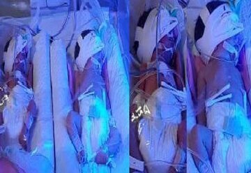 تولد چهار قلو دیواندرهای تولد چهار قلو دیواندرهای